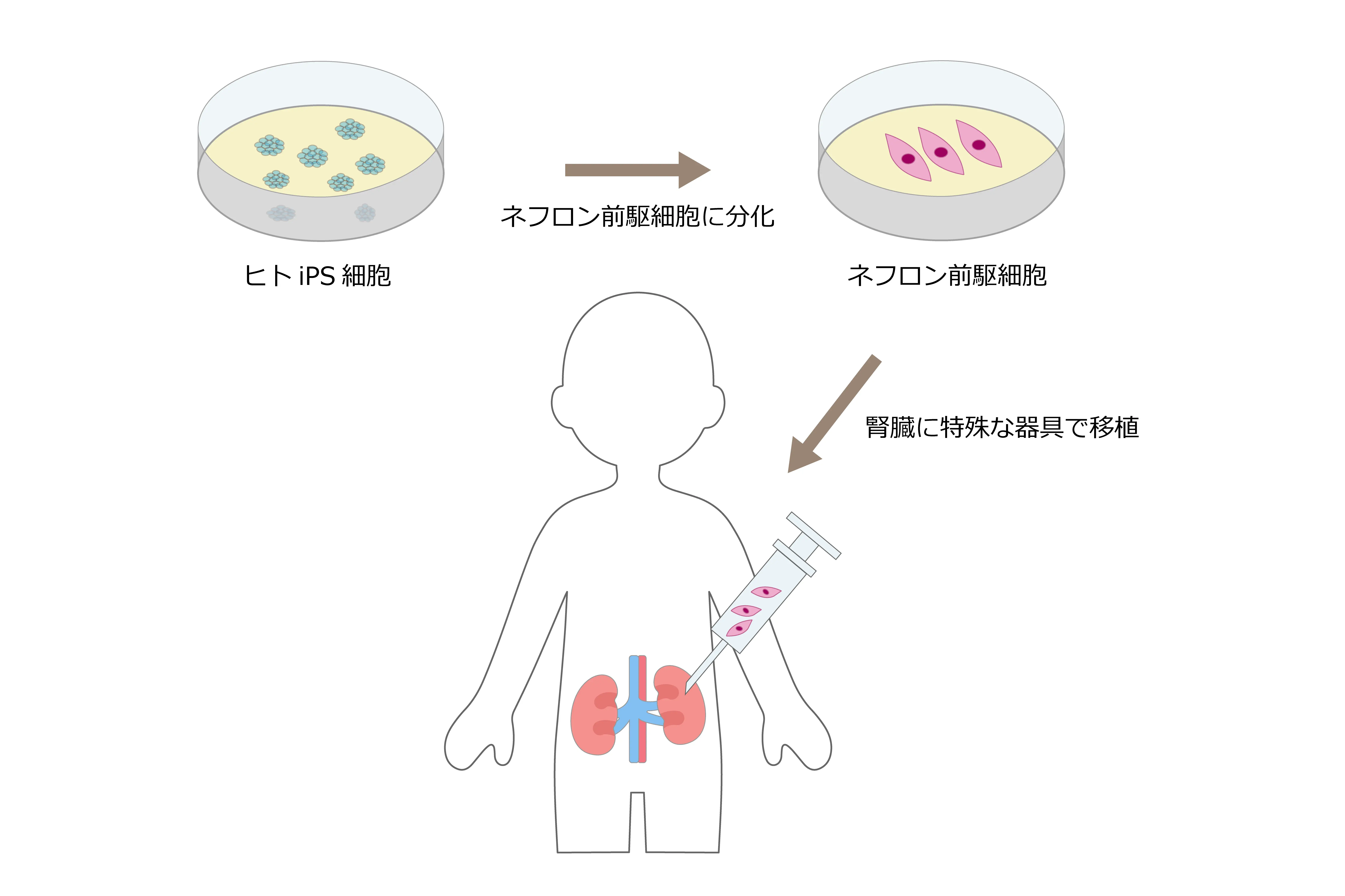 腎細胞療法の仕組み
