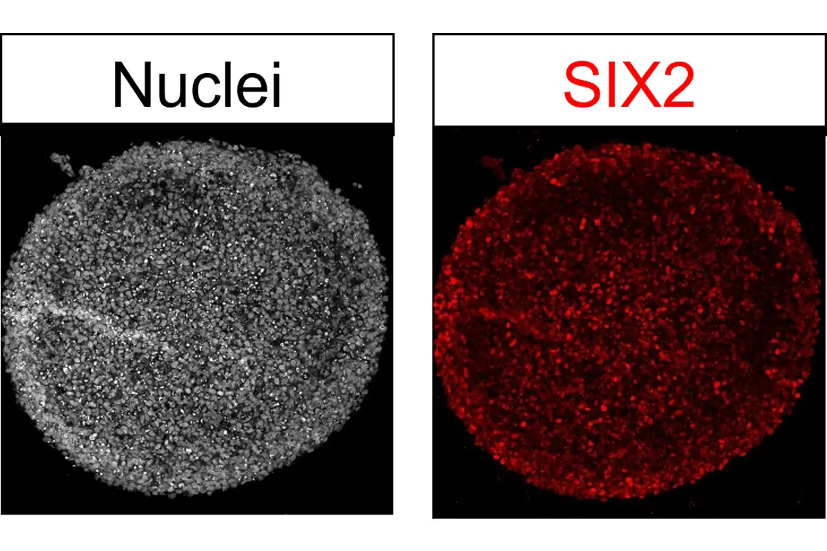 iPS細胞から作製したネフロン前駆細胞